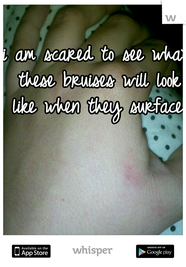i am scared to see what these bruises will look like when they surface.