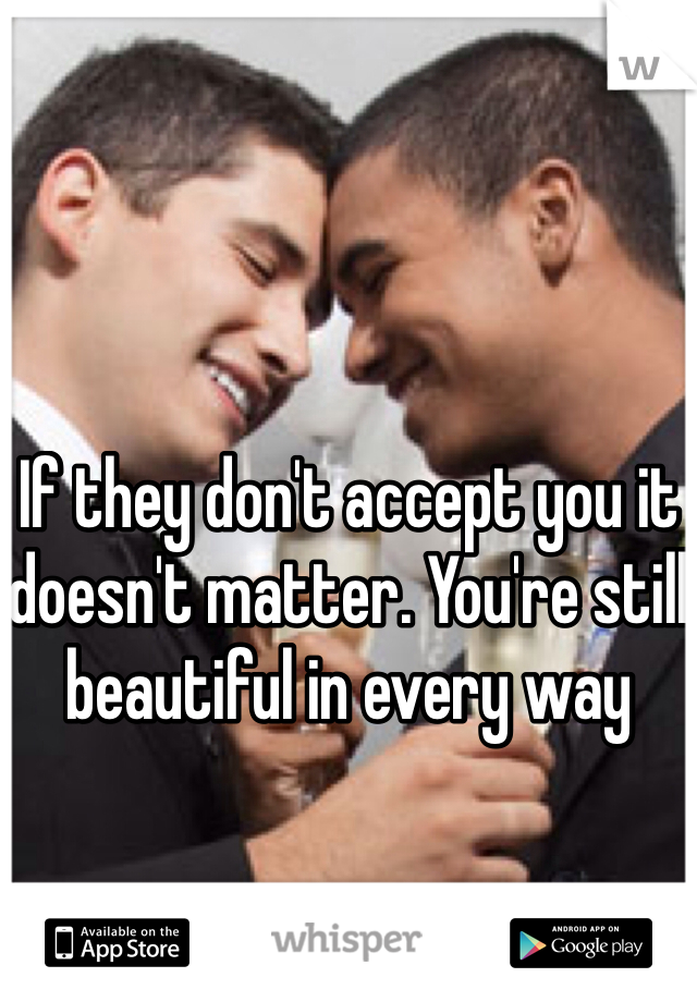 If they don't accept you it doesn't matter. You're still beautiful in every way