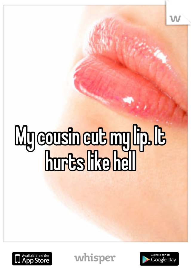 My cousin cut my lip. It hurts like hell
