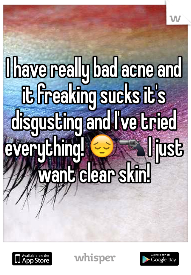 I have really bad acne and it freaking sucks it's disgusting and I've tried everything! 😔 🔫 I just want clear skin! 