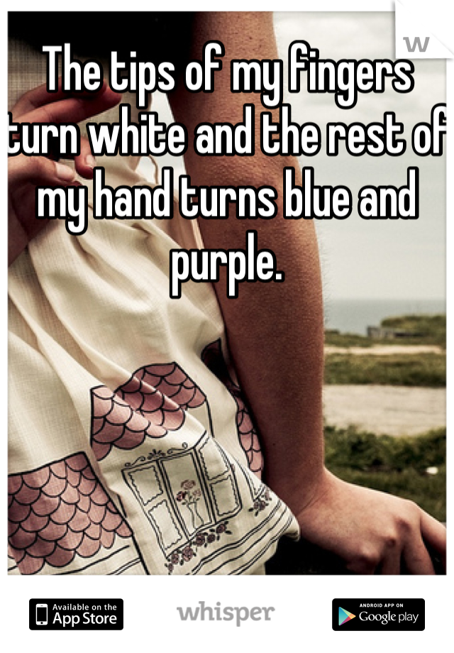 The tips of my fingers turn white and the rest of my hand turns blue and purple.