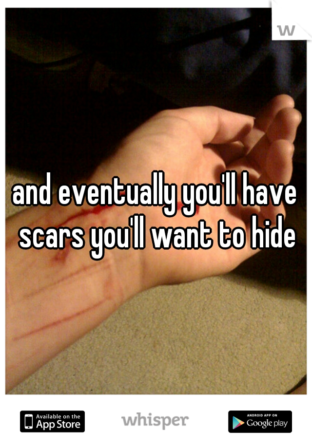 and eventually you'll have scars you'll want to hide