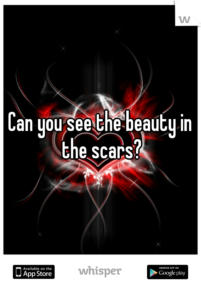 Can you see the beauty in the scars?