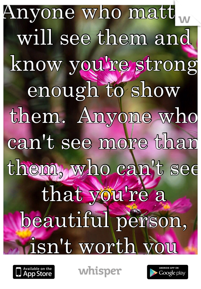 Anyone who matters will see them and know you're strong enough to show them.  Anyone who can't see more than them, who can't see that you're a beautiful person, isn't worth you worrying over what they think.  Stay strong. 