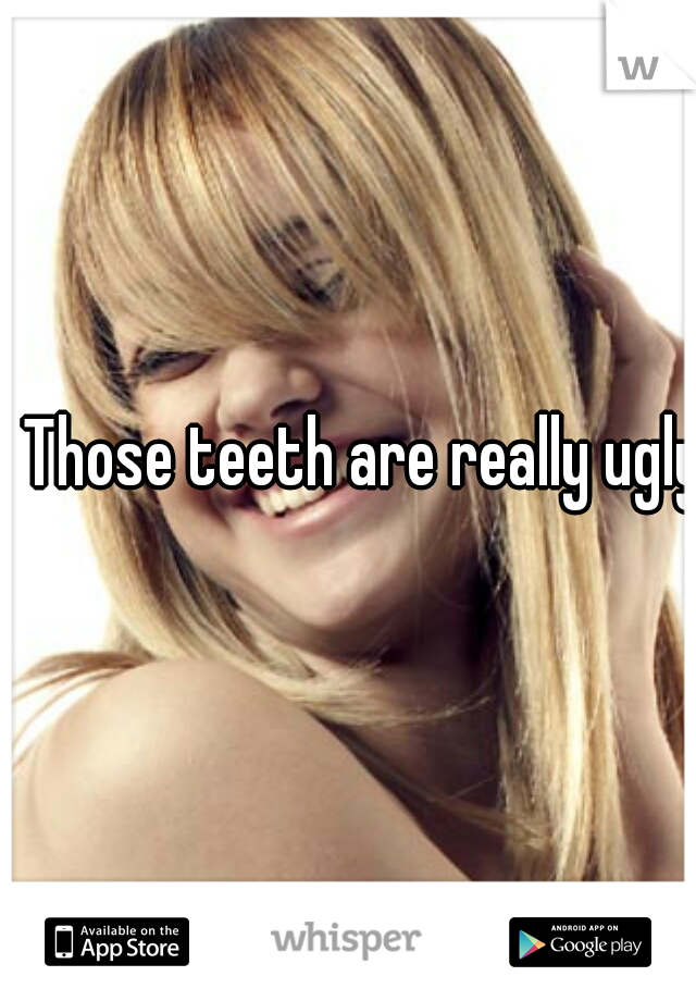 Those teeth are really ugly.
