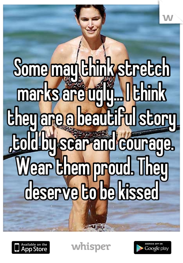 Some may think stretch marks are ugly... I think they are a beautiful story ,told by scar and courage. Wear them proud. They deserve to be kissed