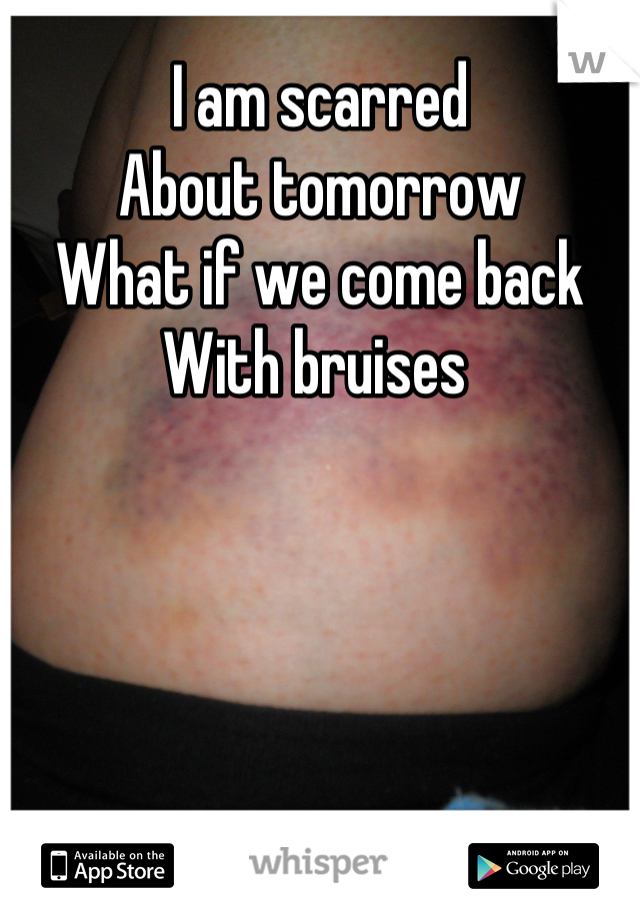 I am scarred 
About tomorrow
What if we come back 
With bruises 
