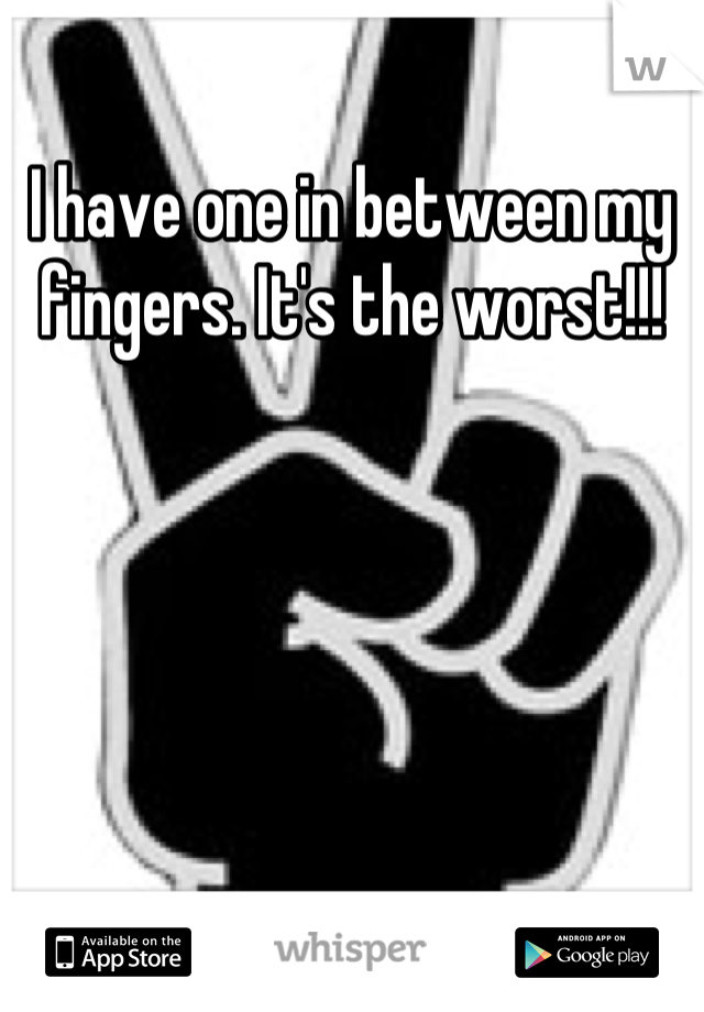I have one in between my fingers. It's the worst!!!