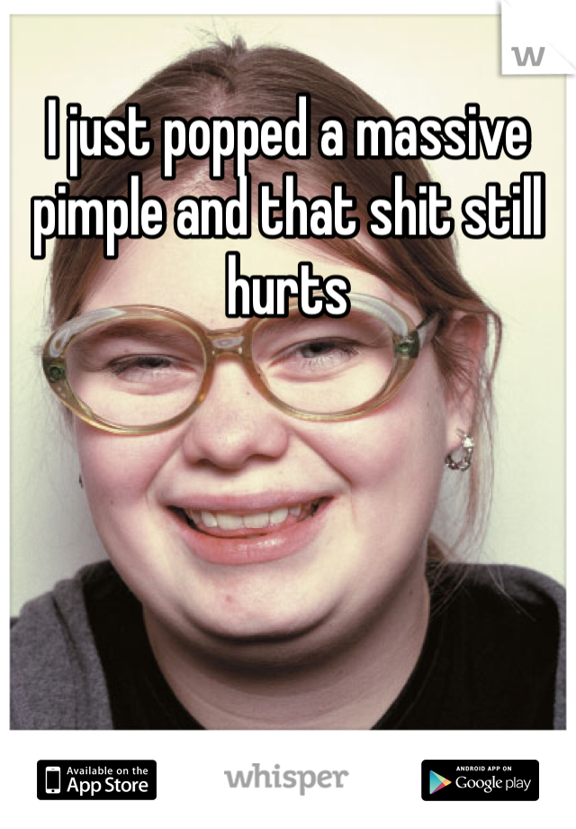 I just popped a massive pimple and that shit still hurts 