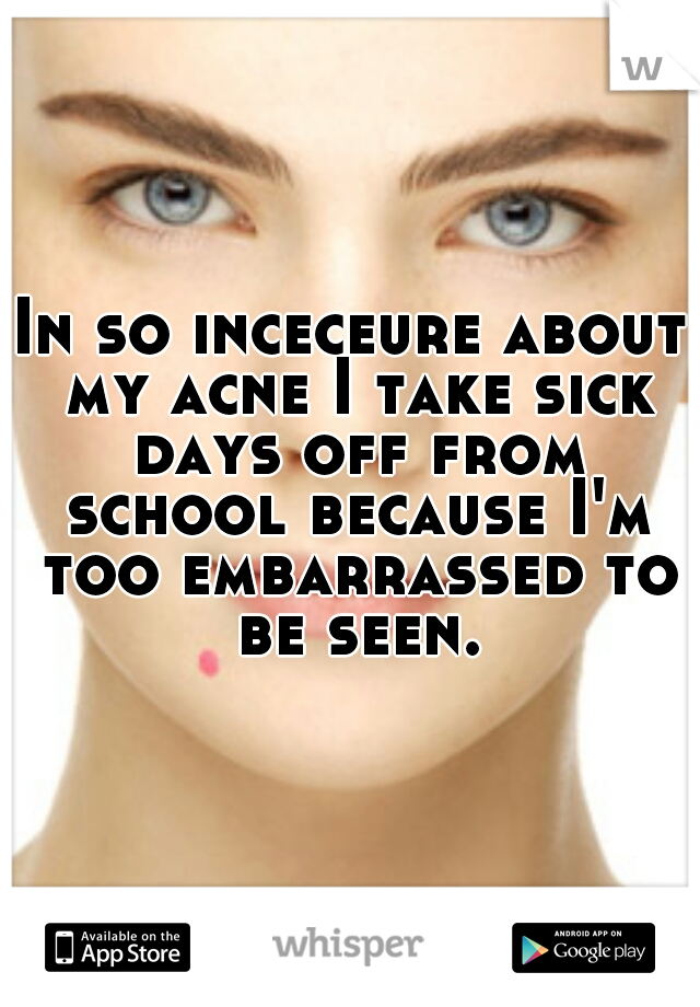 In so inceceure about my acne I take sick days off from school because I'm too embarrassed to be seen.