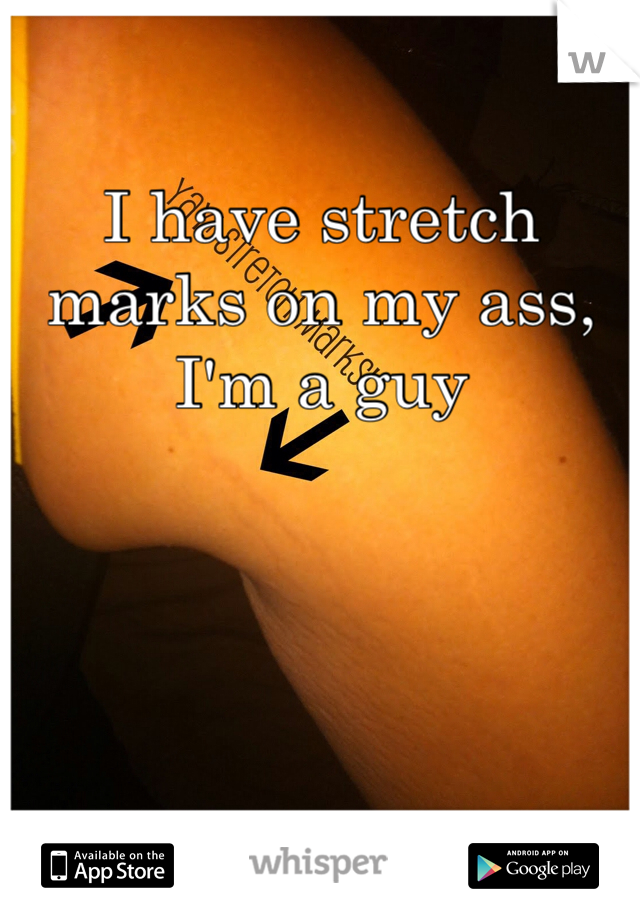 I have stretch marks on my ass, I'm a guy
