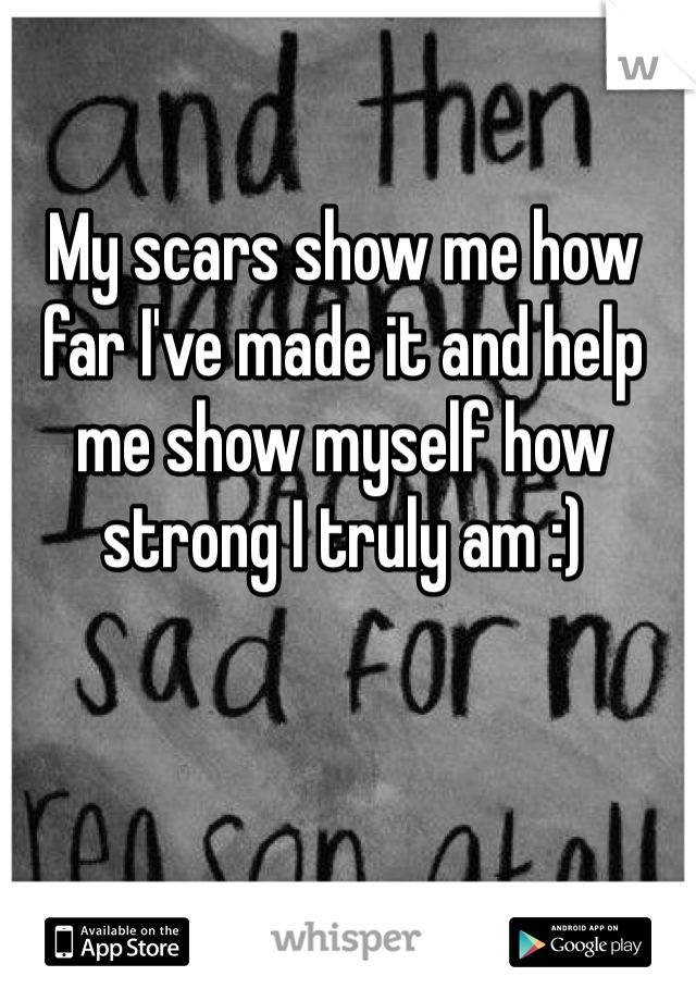 My scars show me how far I've made it and help me show myself how strong I truly am :)