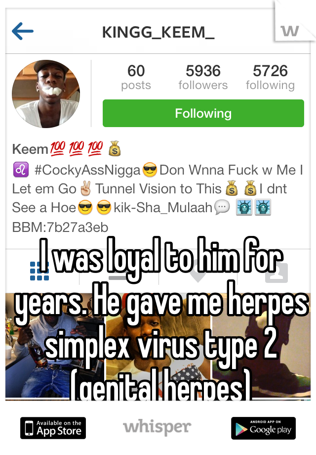 I was loyal to him for years. He gave me herpes simplex virus type 2 (genital herpes) 