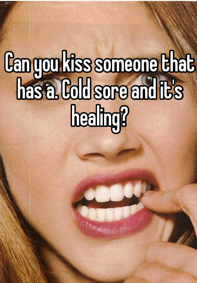 can-you-kiss-with-a-cold-sore