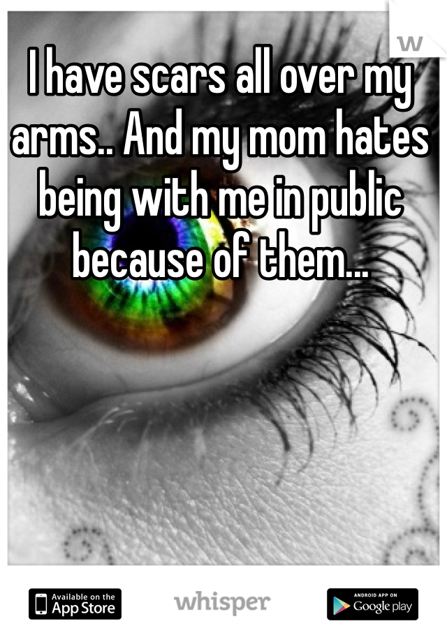 I have scars all over my arms.. And my mom hates being with me in public because of them... 