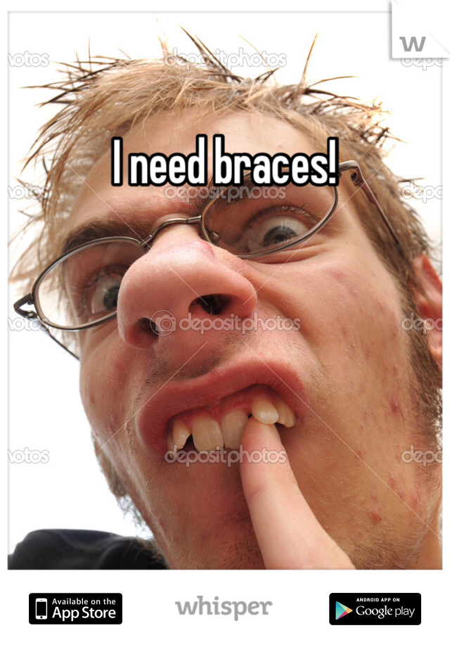 I need braces!