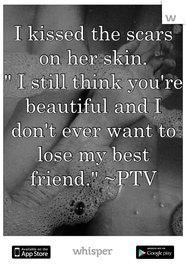 I kissed the scars on her skin.
" I still think you're beautiful and I don't ever want to lose my best friend." ~PTV