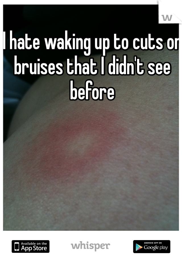 I hate waking up to cuts or bruises that I didn't see before 