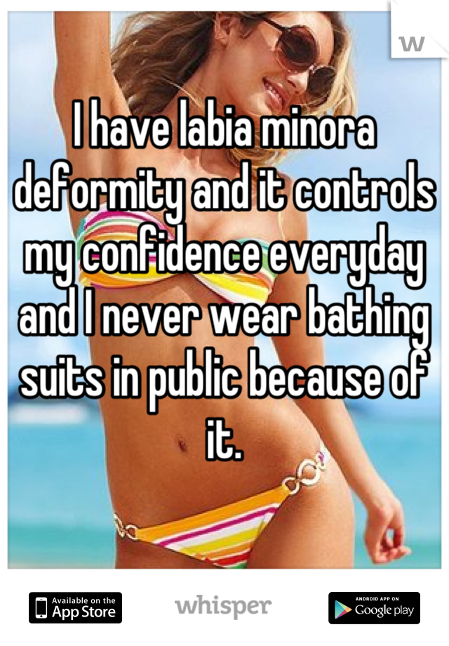 I have labia minora deformity and it controls my confidence everyday and I never wear bathing suits in public because of it.