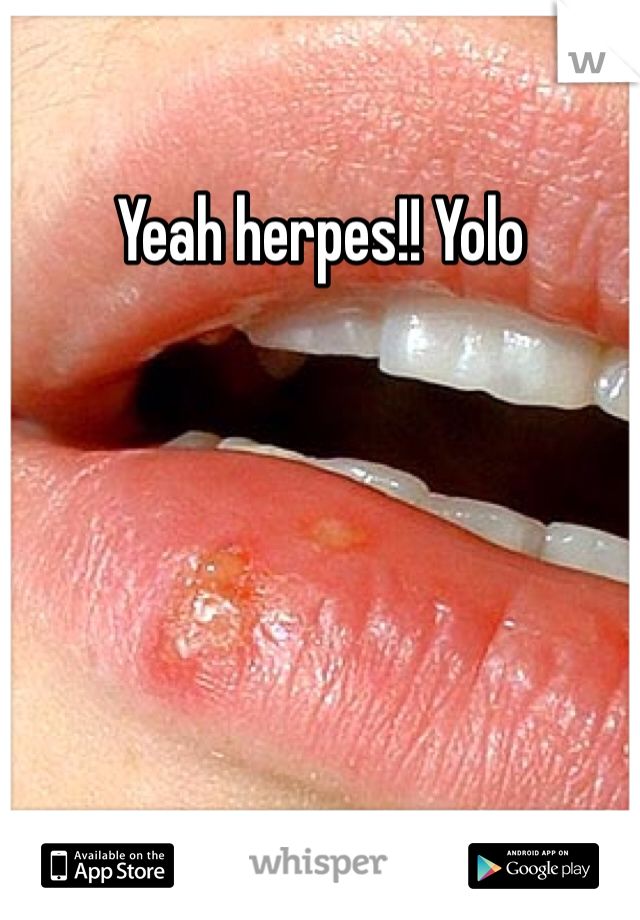 Yeah herpes!! Yolo