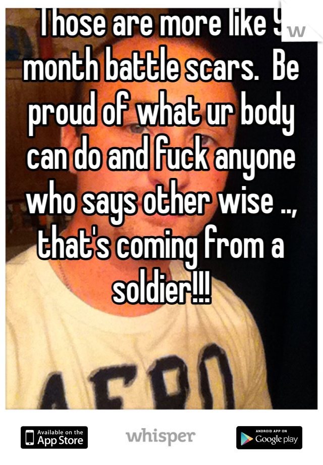 Those are more like 9 month battle scars.  Be proud of what ur body can do and fuck anyone who says other wise .., that's coming from a soldier!!!