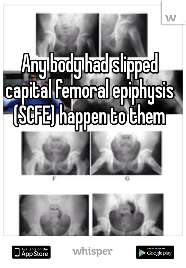 Any body had slipped capital femoral epiphysis (SCFE) happen to them 