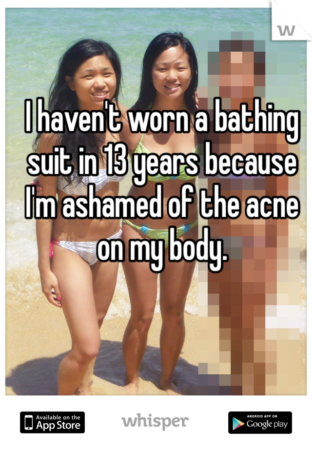 I haven't worn a bathing suit in 13 years because I'm ashamed of the acne on my body.