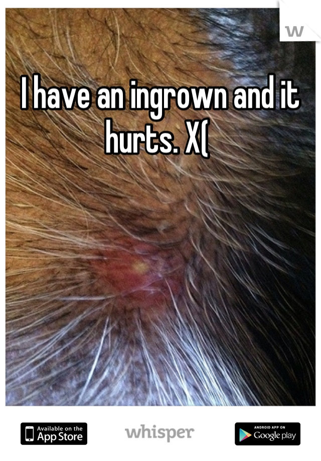 I have an ingrown and it hurts. X( 