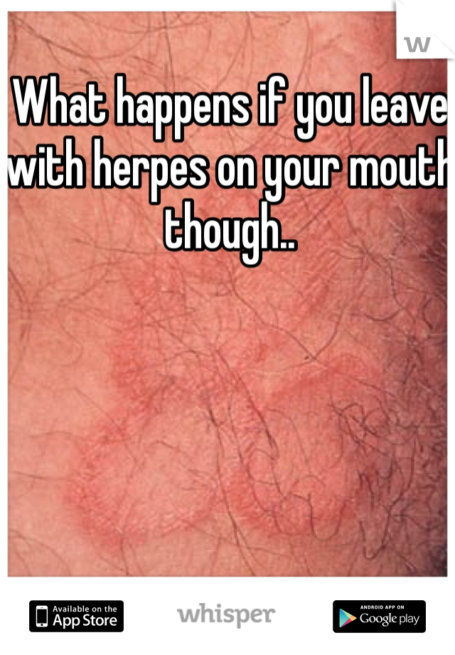 What happens if you leave with herpes on your mouth though..