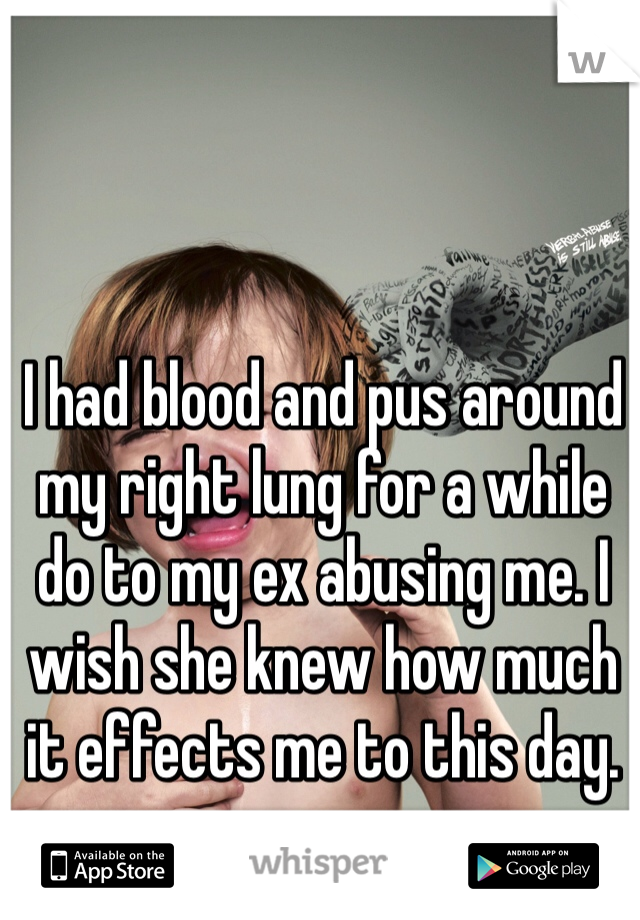 I had blood and pus around my right lung for a while do to my ex abusing me. I wish she knew how much it effects me to this day. 