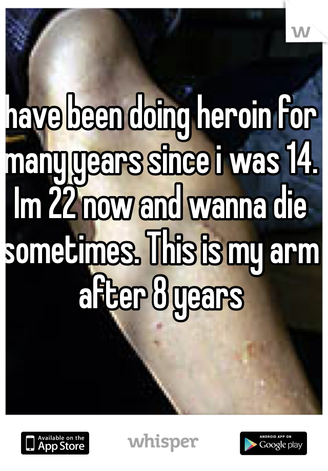have been doing heroin for many years since i was 14. Im 22 now and wanna die sometimes. This is my arm after 8 years
