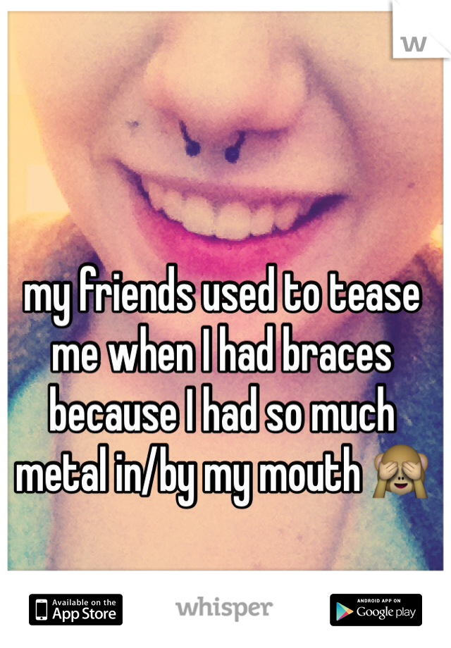 my friends used to tease me when I had braces because I had so much metal in/by my mouth 🙈