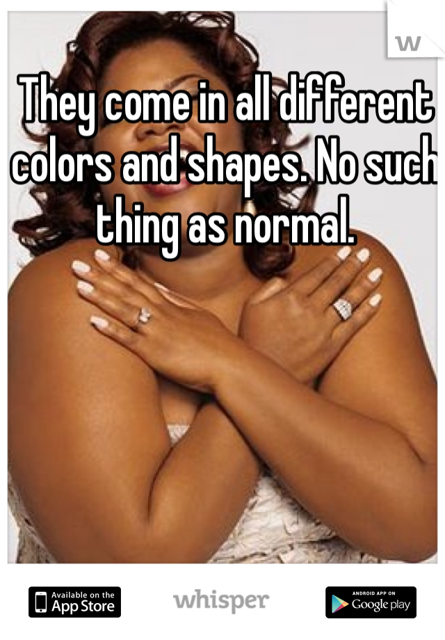 They come in all different colors and shapes. No such thing as normal.