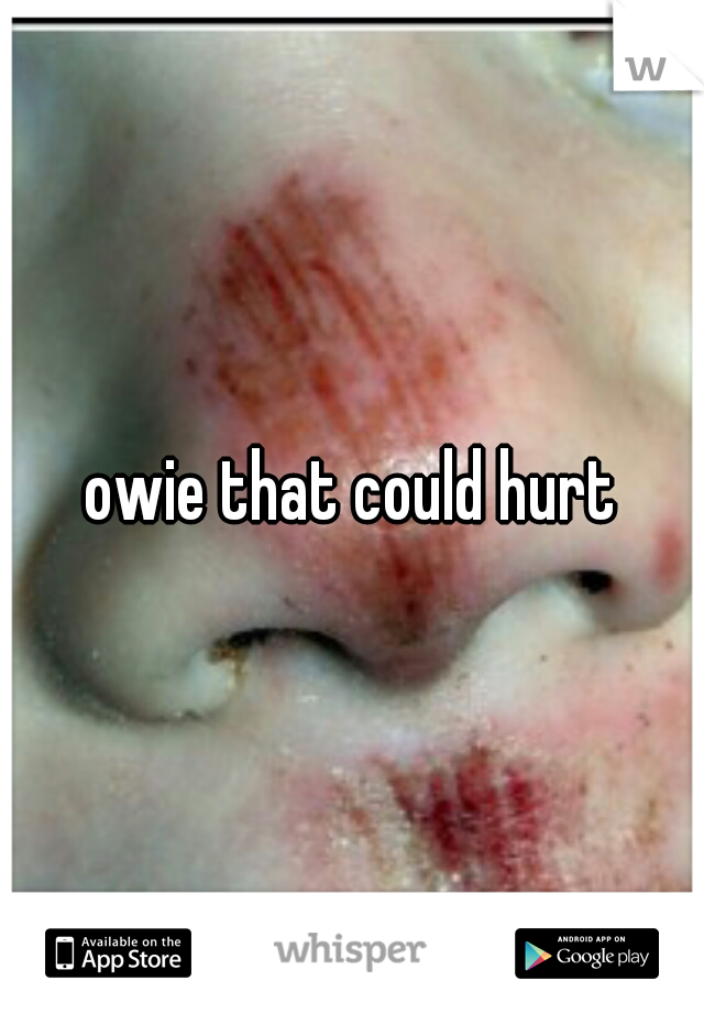 owie that could hurt