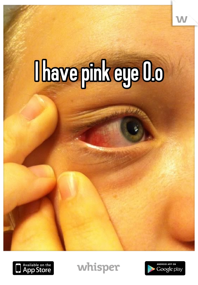 I have pink eye O.o