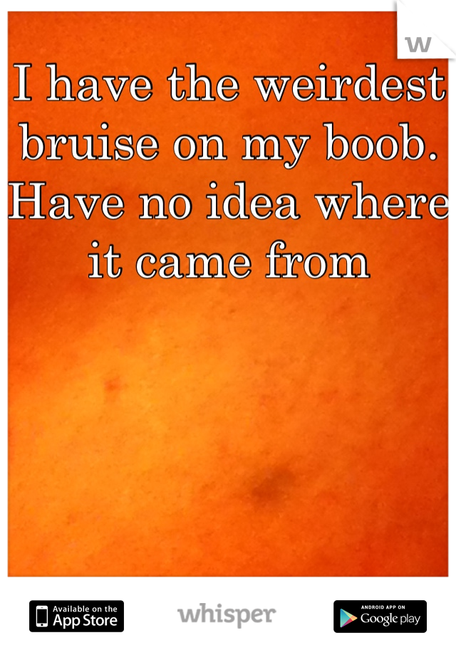 I have the weirdest bruise on my boob. Have no idea where it came from