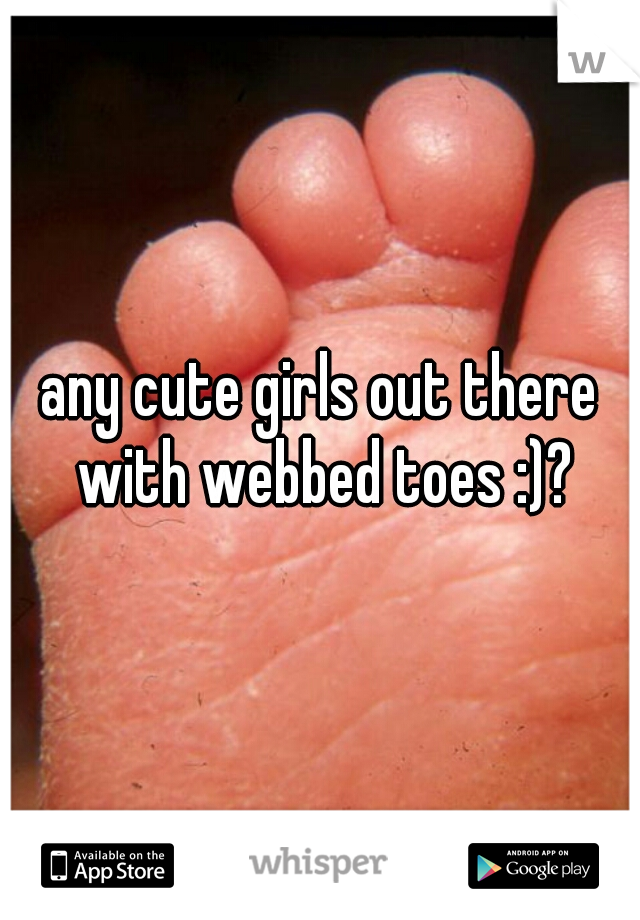 any cute girls out there with webbed toes :)?