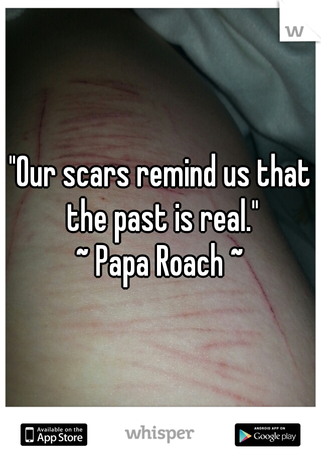 "Our scars remind us that the past is real."
~ Papa Roach ~