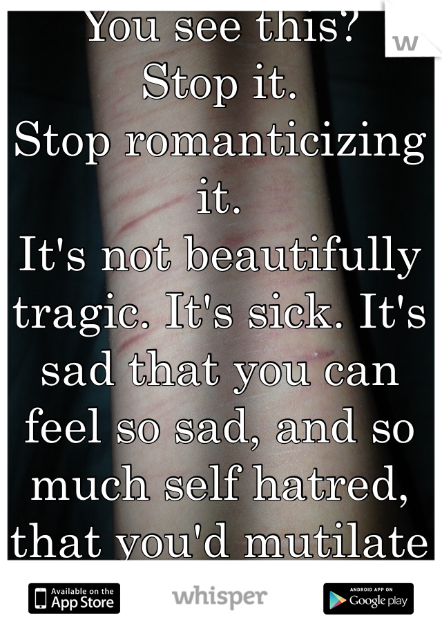 You see this?
Stop it. 
Stop romanticizing it. 
It's not beautifully tragic. It's sick. It's sad that you can feel so sad, and so much self hatred, that you'd mutilate your own body. 