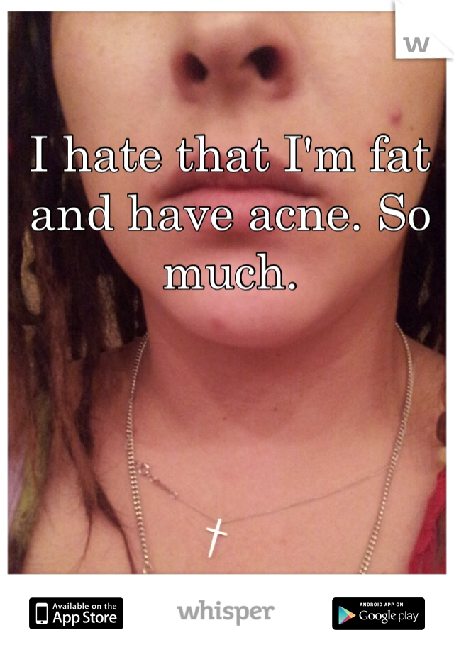 I hate that I'm fat and have acne. So much. 