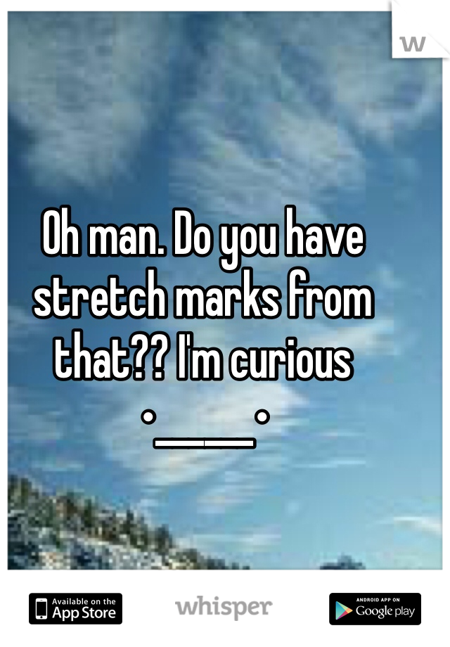 Oh man. Do you have stretch marks from that?? I'm curious •______•