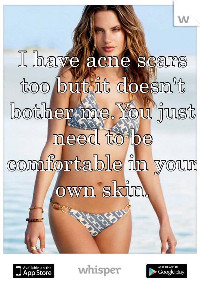I have acne scars too but it doesn't bother me.You just need to be comfortable in your own skin.