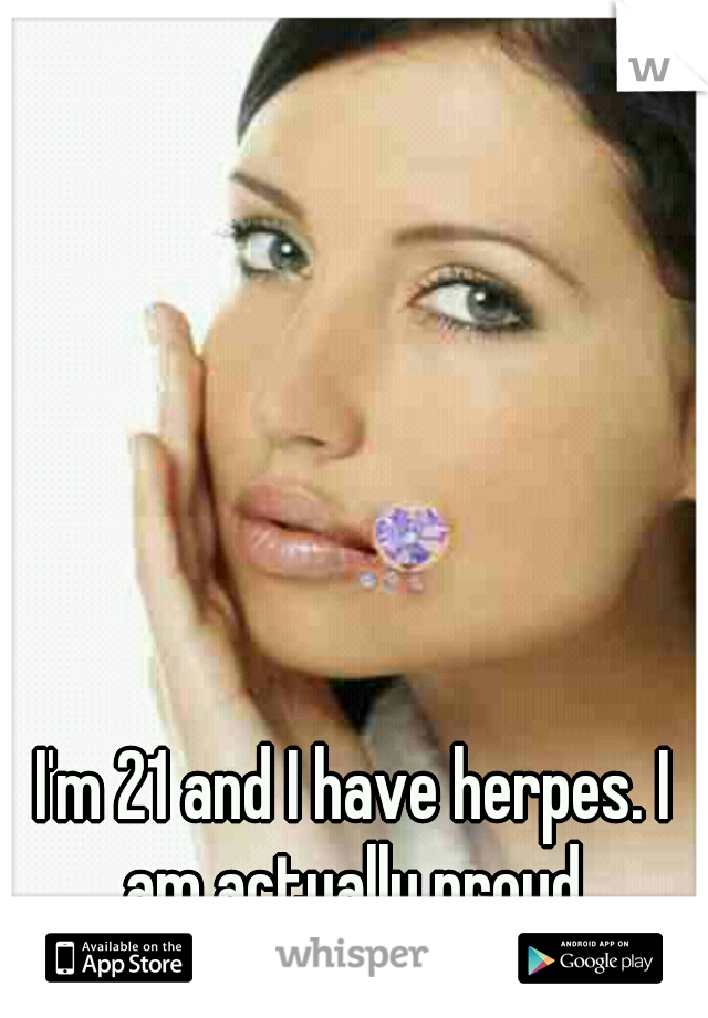 I'm 21 and I have herpes. I am actually proud.