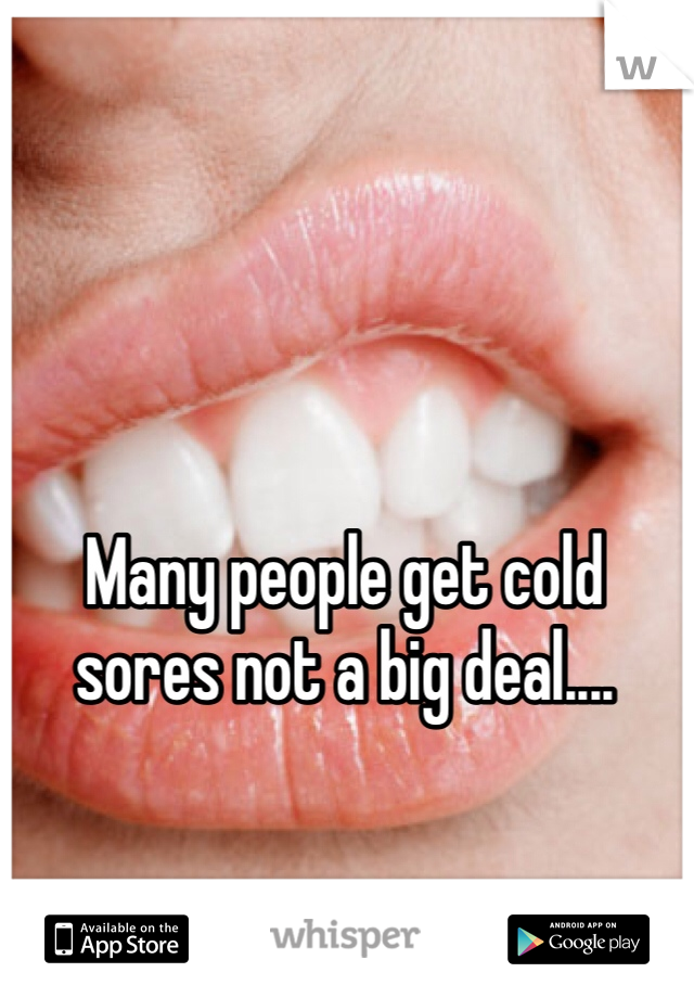 Many people get cold sores not a big deal....
