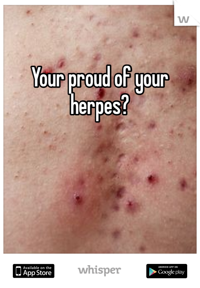Your proud of your herpes? 