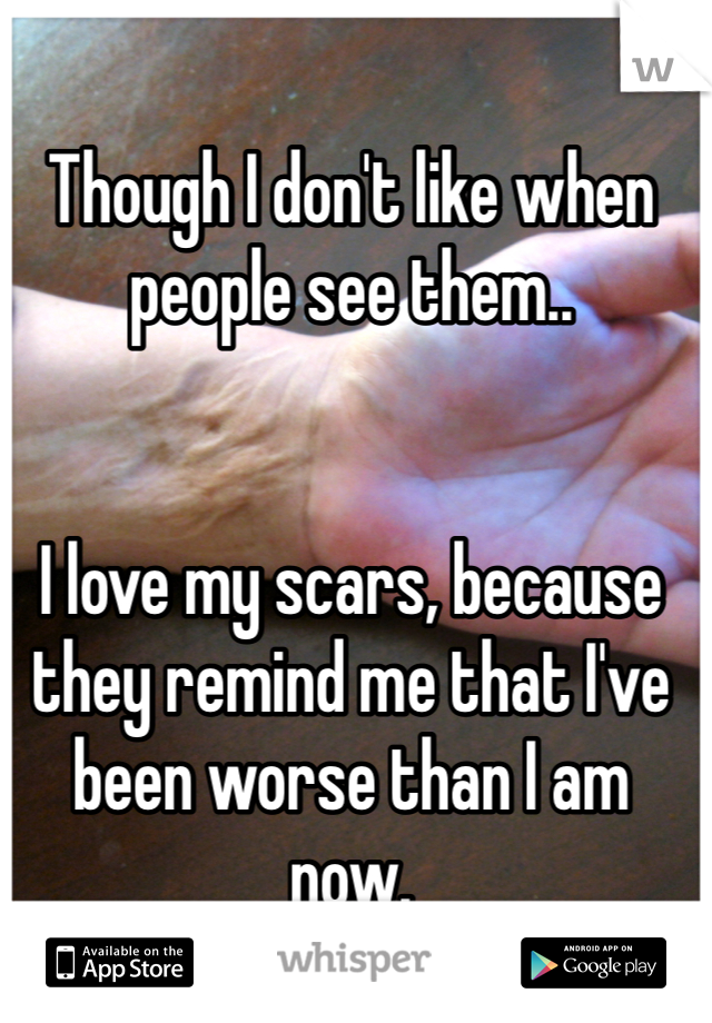 Though I don't like when people see them.. 


I love my scars, because they remind me that I've been worse than I am now. 