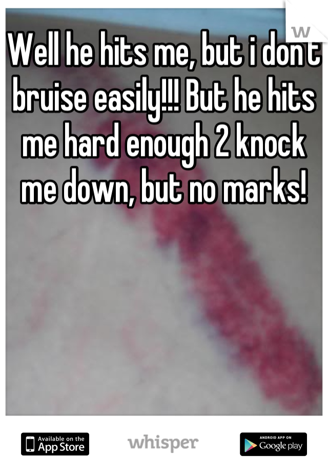 Well he hits me, but i don't bruise easily!!! But he hits me hard enough 2 knock me down, but no marks!
