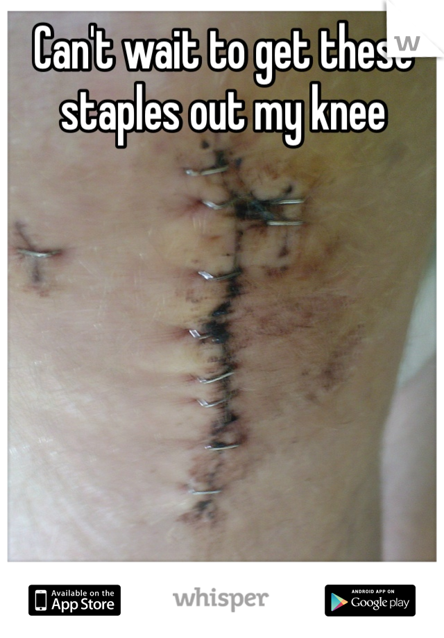 Can't wait to get these staples out my knee