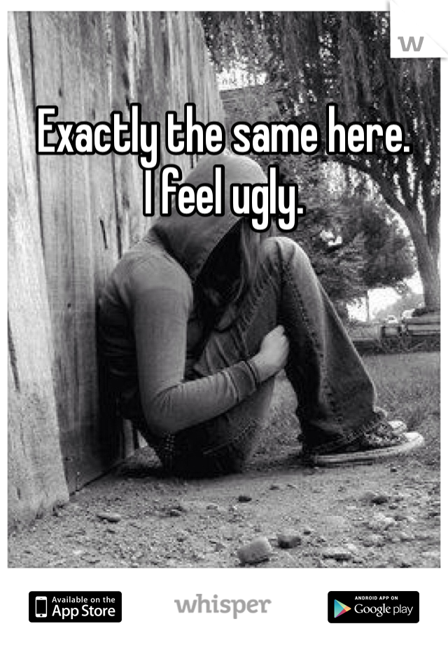 Exactly the same here. 
I feel ugly. 