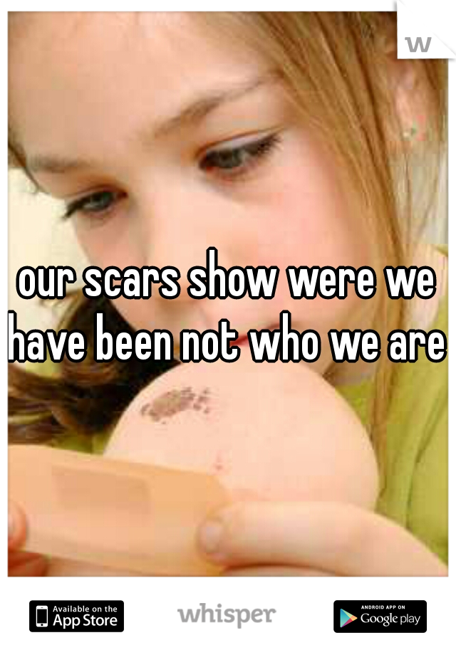 our scars show were we have been not who we are 